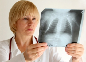 ВОЗ предупреждает о возвращении туберкулеза