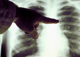 Диагностика болезней органов дыхания