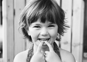 Смена молочных зубов у детей