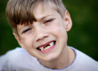 Молочные зубы у детей и их смена
