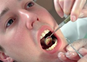 Лечение остеомиелита челюсти у стоматолога