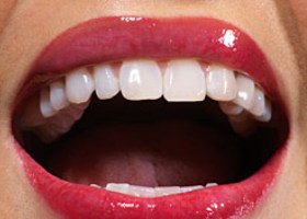 Синдром мышечно-суставной дисфункции полости рта