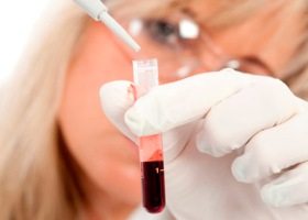 Группа крови поможет определить склонность к болезням