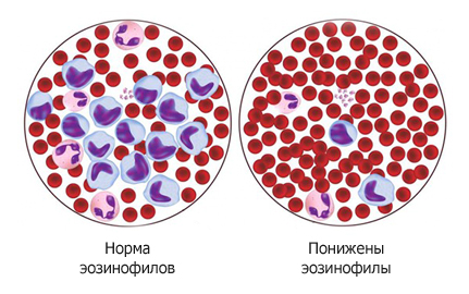 Уровень эозинофилов в крови