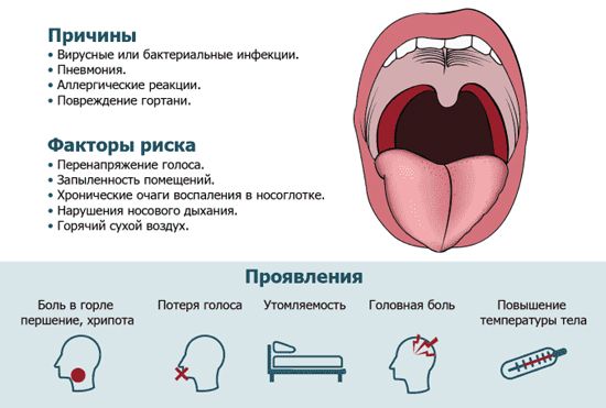 Причины фарингита