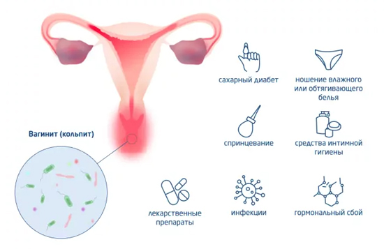 Причины возникновения кольпита