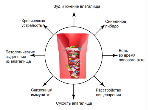 Симптомы кольпита