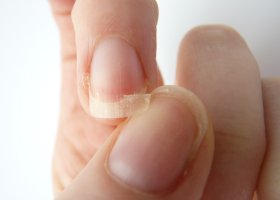 Почему крошатся ногти на руках лечение в домашних условиях thumbnail