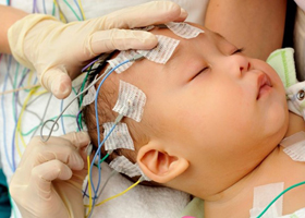 Детям раннего возраста ЭЭГ желательно проводить во время сна