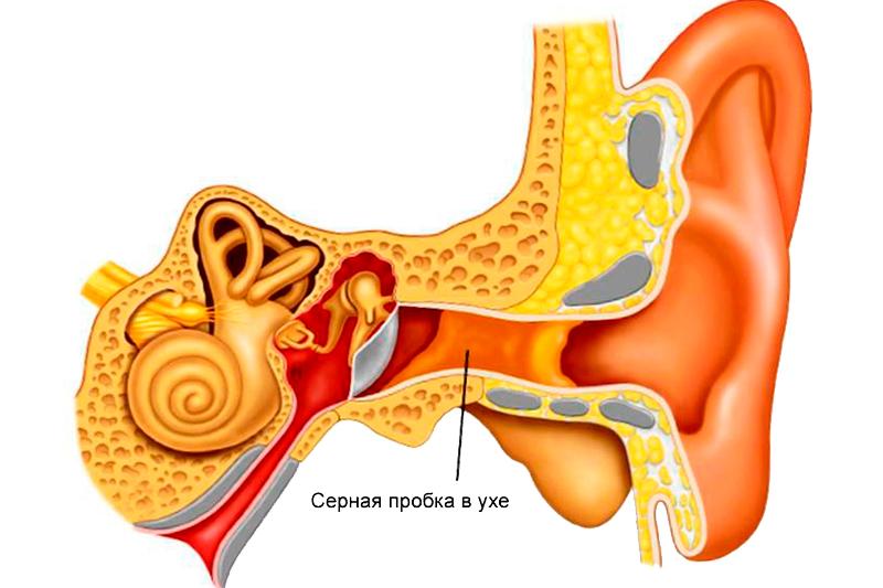 Как вылечить заложенность уха у взрослого
