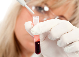 Ученые рассказали, какая группа крови самая «сильная»