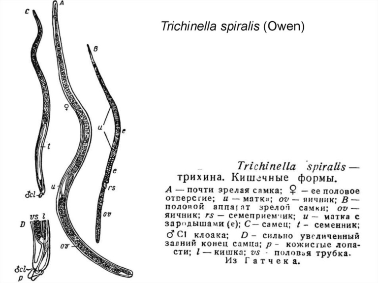 Строение трихинеллы рисунок