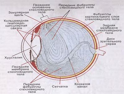 Деструкция стекловидного тела глаза лечение симптомы thumbnail