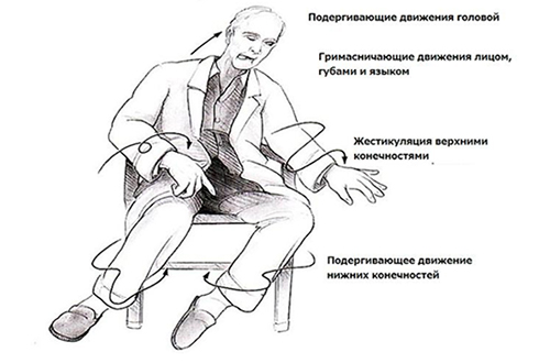 Болезнь кенсингтона что это такое. Смотреть фото Болезнь кенсингтона что это такое. Смотреть картинку Болезнь кенсингтона что это такое. Картинка про Болезнь кенсингтона что это такое. Фото Болезнь кенсингтона что это такое
