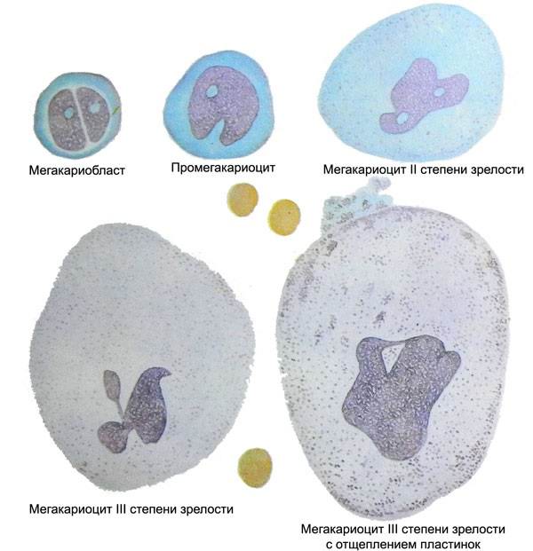 Локализация геморрагической сыпи при тромбоцитопенической пурпуре