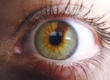 Гетерохромия глаз