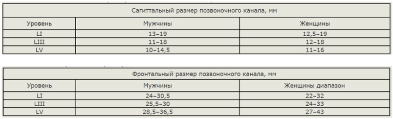Лечение стеноза позвоночного канала поясничного отдела, шейного отдела ...