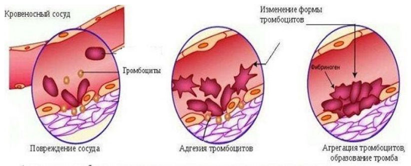 Тромбоцитоз
