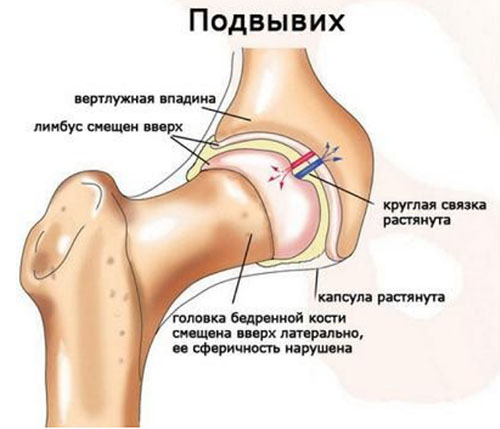 ротационный подвывих с1 код по мкб 10 у детей