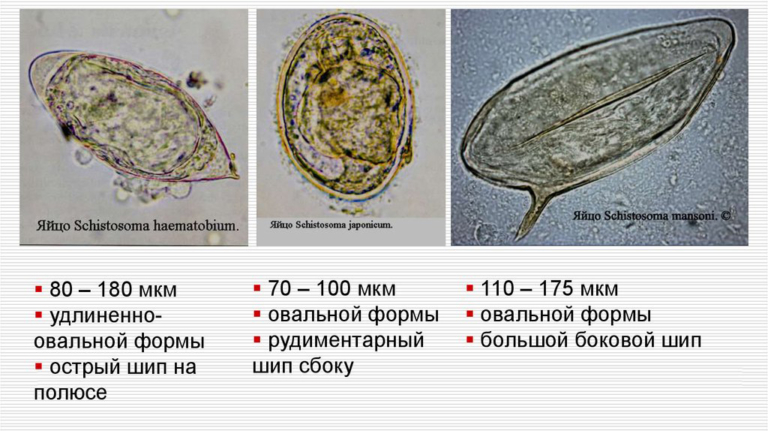 Шистосома фото паразита размеры