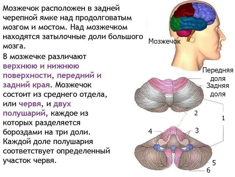 Опухоль головного мозга (рак мозга)