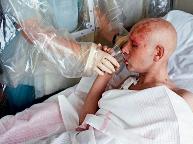 какая доза радиации и какие симптомы характерны для лучевой болезни 4 ой степени. Смотреть фото какая доза радиации и какие симптомы характерны для лучевой болезни 4 ой степени. Смотреть картинку какая доза радиации и какие симптомы характерны для лучевой болезни 4 ой степени. Картинка про какая доза радиации и какие симптомы характерны для лучевой болезни 4 ой степени. Фото какая доза радиации и какие симптомы характерны для лучевой болезни 4 ой степени