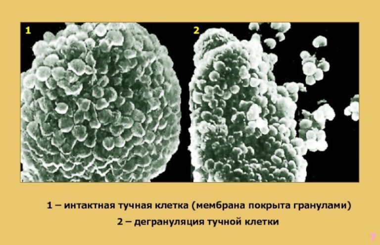 У ребенка мастоцитоз фото