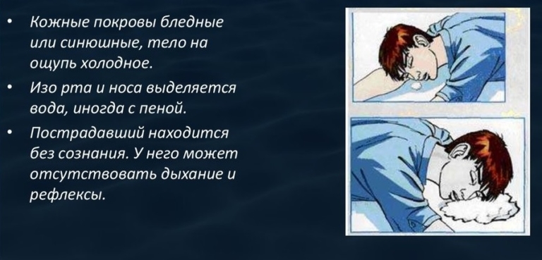 Какие опасные для жизни осложнения могут возникнуть у пострадавшего после утопления