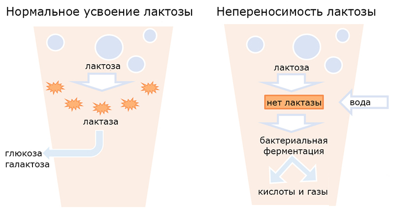 При дисахаридазной недостаточности характерен стул