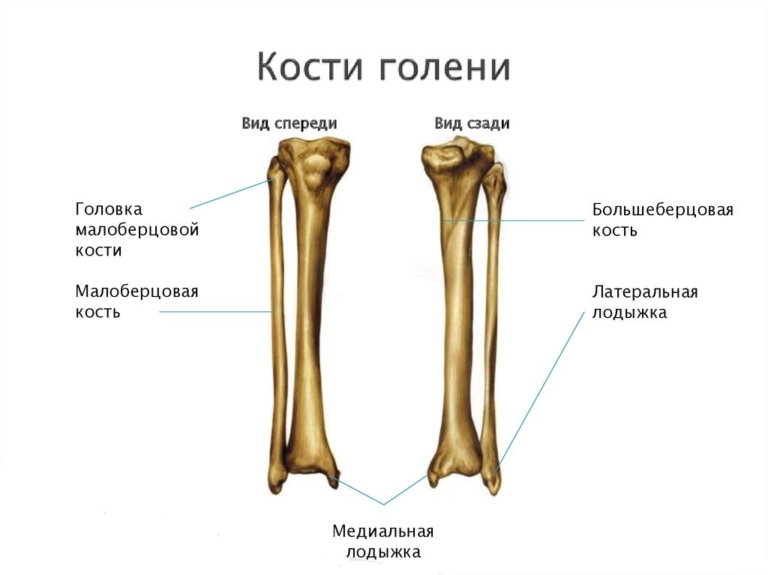 Берцовая кость человека фото где Перелом ноги: сколько ходить в гипсе. Как разработать ногу после переломов малой