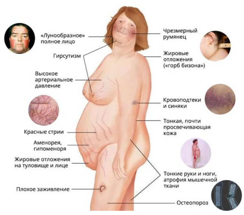 Феохромоцитомы и опухоли надпочечников