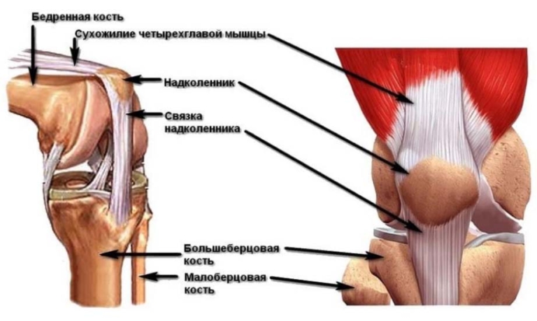 Medside Хондромаляция надколенника и коленного сустава - Medside.ru