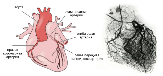 Анатомия коронарных артерий и системы коронарного кровообращения