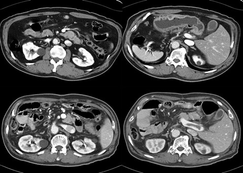 Пример МРТ-снимков органов брюшной полости