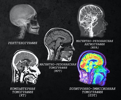 Визуализация мозга с помощью разных диагностических методов