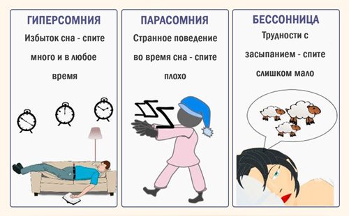 Основные виды нарушений сна