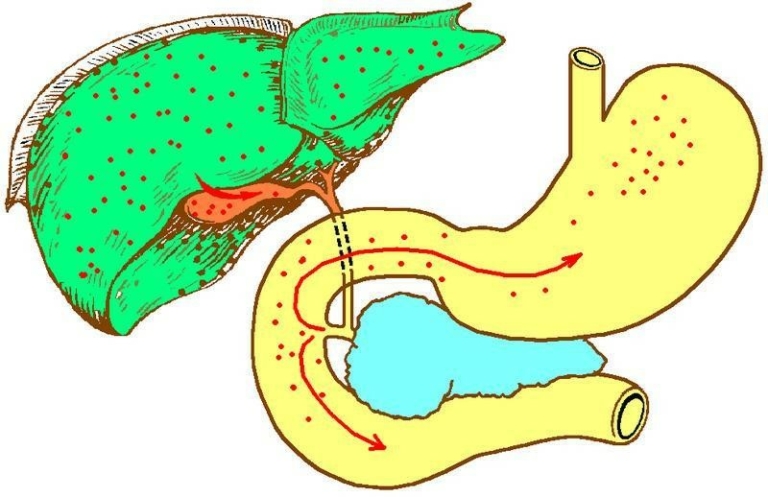 Рвота: как остановить у детей и взрослых, таблетки и лекарства. Причины ...