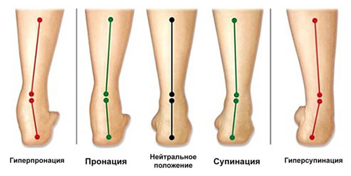 Положение стопы во время ходьбы или бега