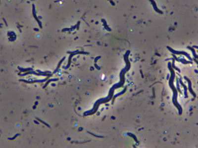 Бактерии спириллы под микроскопом