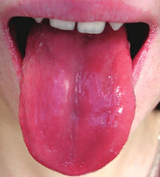 Красный блестящий язык