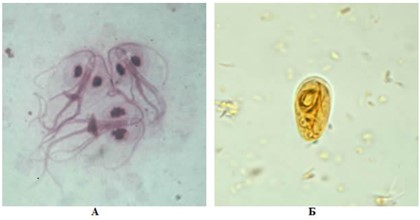 Микроскопия Lamblia intestinalis: А – трофозоит, Б – циста