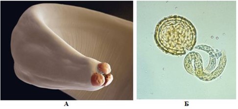 Ascaris lumbricoides: А – ротовое отверстие с тремя губами, Б – личинка, высвободившаяся из скорлупы яйца