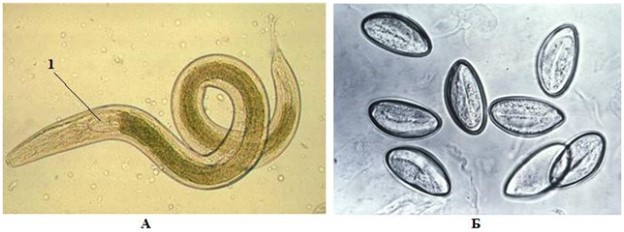 Enterobius vermicularis: А – тотальный препарат (самка, 1 – бульбус, шарообразное расширение, участвующее в фиксации паразита к кишечным стенкам), Б – яйца в кале у ребенка (влажный микропрепарат)