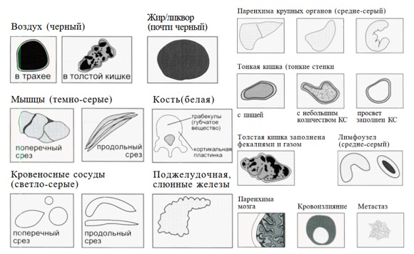 Схематичное изображение различных анатомических образований и патологических изменений на томограммах