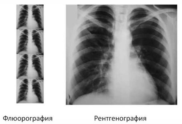 Сравнение размера и качества изображения при ФГ и РГ