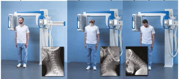 Шейный отдел позвоночника в боковой проекции и с функциональными пробами