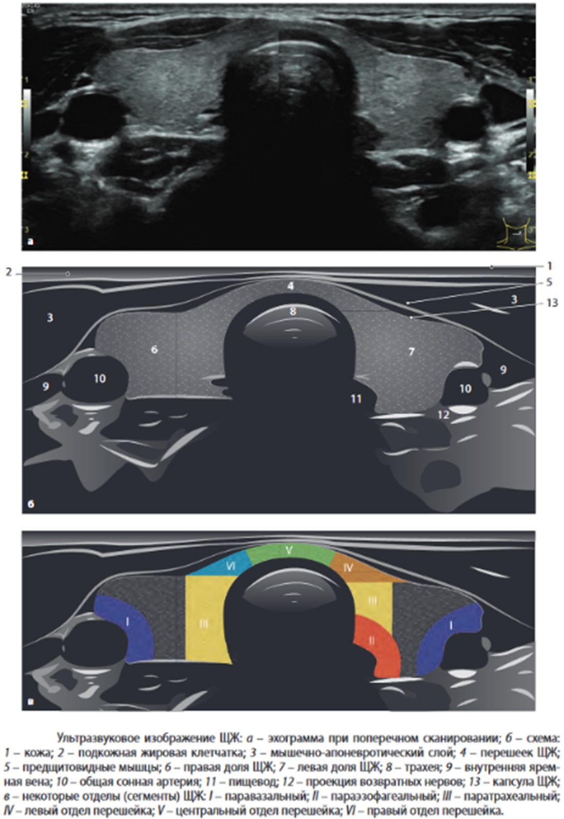 Топографо-анатомическое соотношение органов шеи на схеме и эхограмме