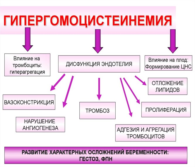 Гипергомоцистеинемия Гипергомоцистеинемия