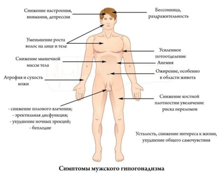 Андрогенный дефицит