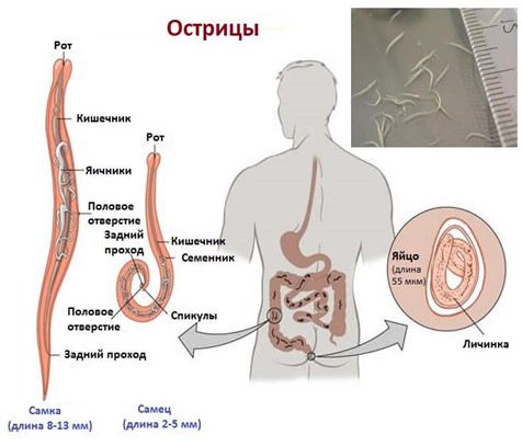 Острицы